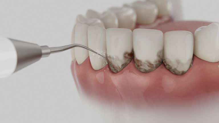 Trusted Emergency Dentist service in Brookmont, MD - Dentist Open Now